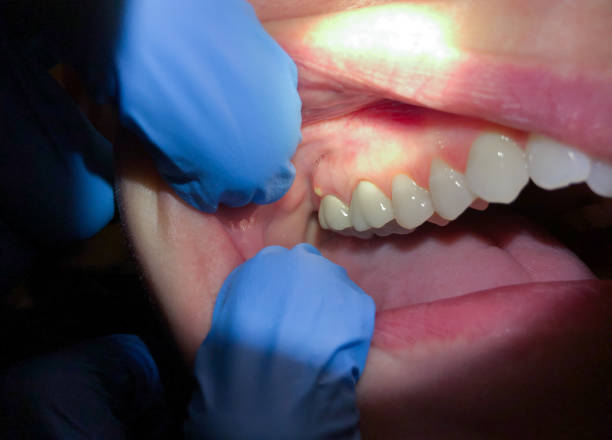 Best Broken or Cracked Tooth Emergency Dentist in Peppermill Village, MD